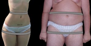 Image - how to measure waist to hip ratio